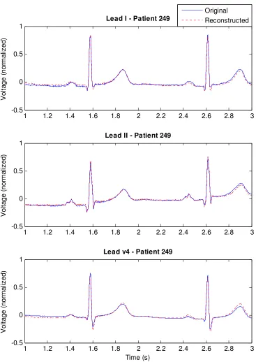 Figure 2-3. Plot of original and reconstructed leads for a male, age 46, of the myocarditis test group