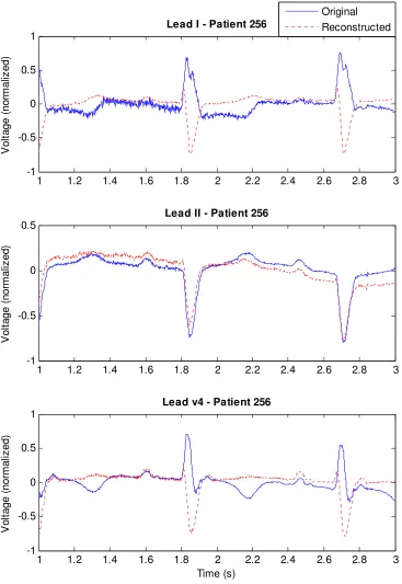 Figure 2-4. Plot of original and reconstructed leads for a female, age 64, of the cardiomyopathy test group