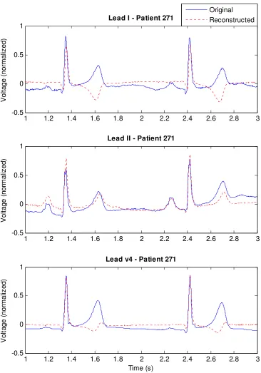 Figure 2-5 Plot of original and reconstructed leads for a male, age 41, of the myocarditis test group