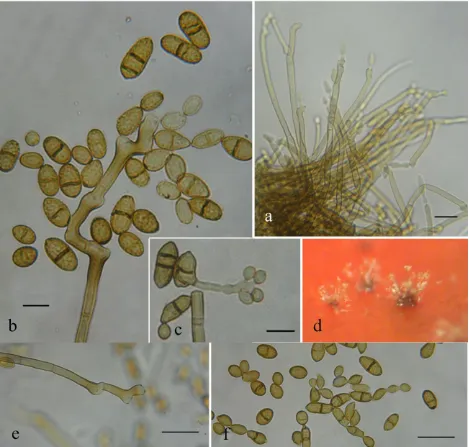Fig. 4 Colony on fruit of . Cladosporium macrocarpum. a. Conidiophores in vivo; b. Conidiophores in vitro; c