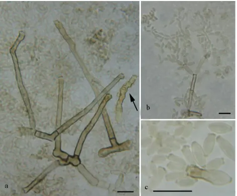 Fig. 6. ramoconidia with several hila. — Scale bars = 10 µm. Cladosporium pannosum. a