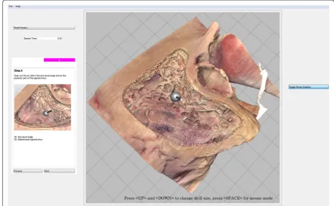 Fig. 1 Screenshot from the Visible Ear Simulator with drilling of the virtual temporal bone
