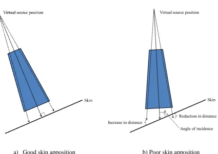 Figure 2.2 Electron setup and skin apposition 