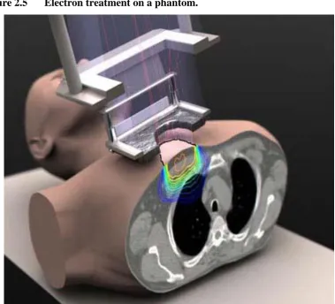 Figure 2.5 Electron treatment on a phantom. 