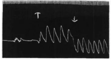 Fig. 4. Rhythmic after-discharge following the application (j) and removal (f) of 10 g.