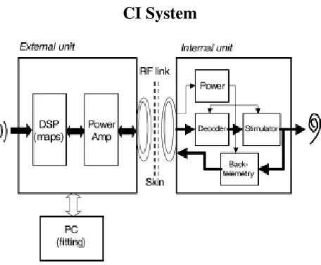 Figure 2.4: Functional Diagram of a Standard Cochlear Implant [5]
