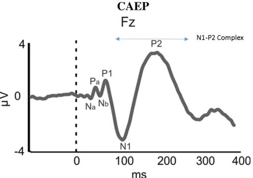 Figure 2.5: Normal Hearing CAEP with Marked N1-P2 Complex [21]