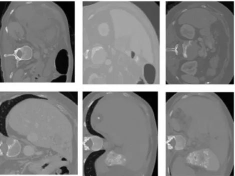 Fig.  5: Sample of CT Dataset 