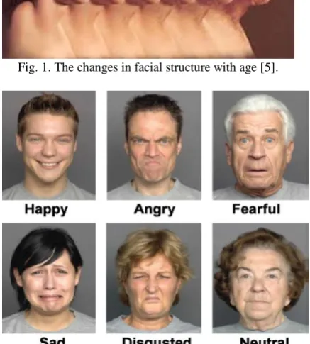 Fig. 1. The changes in facial structure with age [5].  