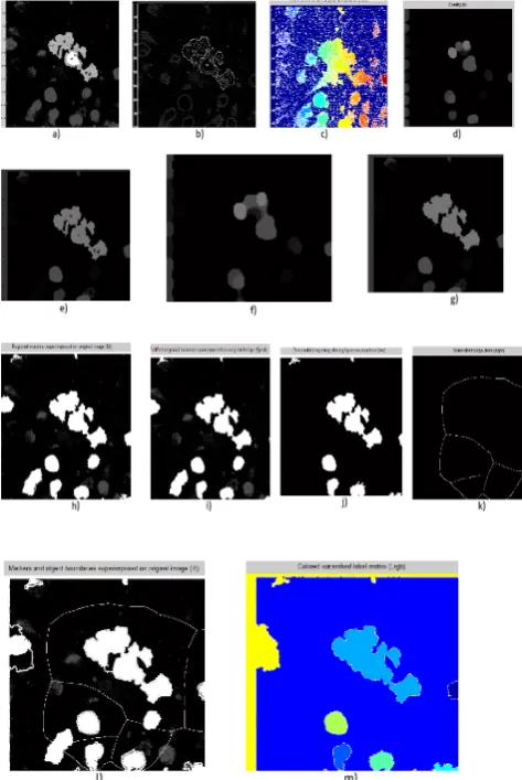 Figure 10 a)Grey scale image b)Computing gradient magnitude c)Watershed transform of gradient magnitude  l)Marker and objects boundaries superimposed  m)Color watershed label matrix d)Marking foreground objects e)Opening by reconstruction  f)Opening closing g)Opening-closing by reconstruction  h)Regional maxima superimposed i)Modified regional  maxima superimposed j)Thresholding k)Watershed ridges                                                                                                                          