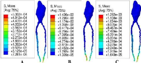 Figure 2(A, B, C) Von Mises stress distribution for 1N/mm2 for 0% resorption level: A-Coronal apical load; B-Vestibulo-lingual load; C-Mesio-distal load  
