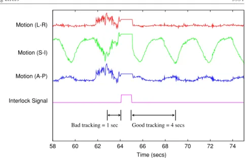 Figure 2. An interval of 1 s previous to each tracking interlock is assumed to be a tracking error, and an interval of 4 s after the interlock is cleared is assumed to be error free.