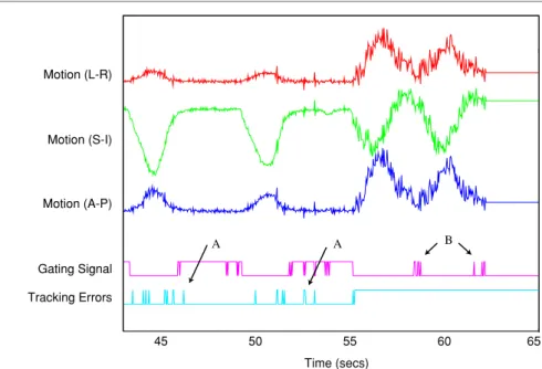 Figure 7. Tracking errors while the MV beam is delivering treatment.