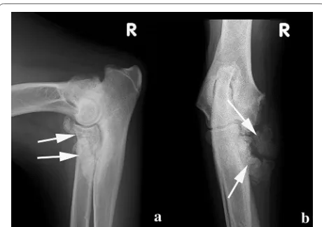 Fig. 4 Medio-lateral (a) and cranio-caudal (b) radiographs of the right elbow 10 months post-operative