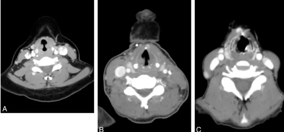 Fig 3. The odds ratio comparing phonation to the breath-hold technique is given above the glottis, at the glottis, and below the glottis