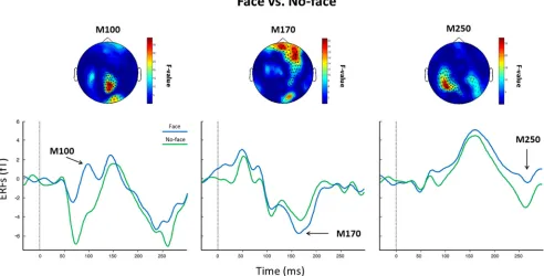 Figure 4.Sensor-level statistics. Shown is the main effect of condition (face vs no-face) for the M100 (left), M170 (middle), and M250 (right)