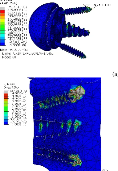 Fig 6: Deformation of the Scapula in Full Shoulder Model between (a) 0mm to 0.63mm and (b) 0.05mm to 0.15mm  