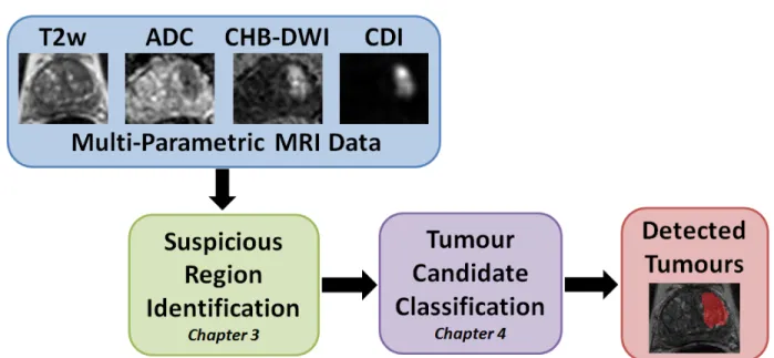 Figure 1.1: The proposed comprehensive framework for computer-aided prostate cancer detection via suspicious region detection and tumour candidate classification using  multi-parametric MRI