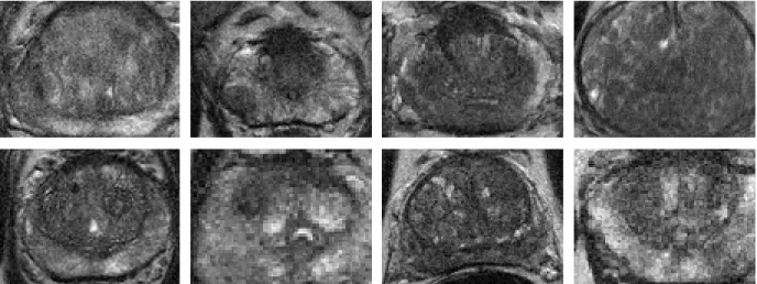 Figure 2.1: Sample T2-weighting images from eight different patients. Note that cancerous regions are extremely difficult to identify visually in this modality.