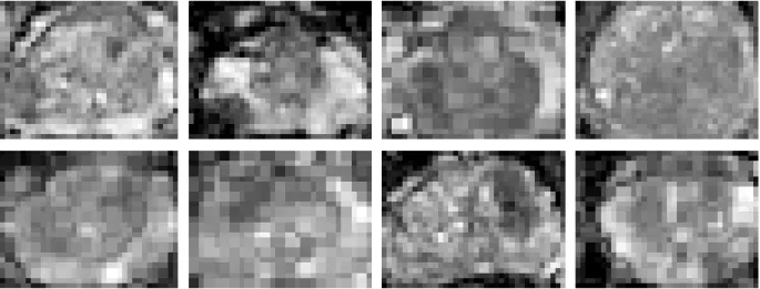 Figure 2.2: Sample apparent diffusion coefficient maps computed from diffusion-weighted images from eight different patients