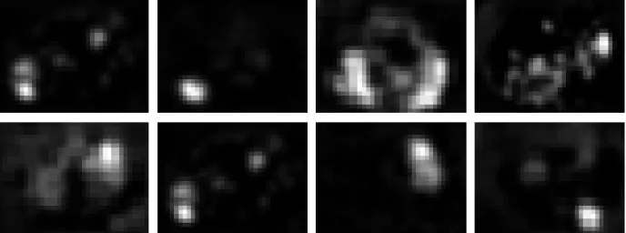 Figure 2.4: Sample correlated diffusion images (computed using Eq. 2.8) from eight differ- differ-ent patidiffer-ents.