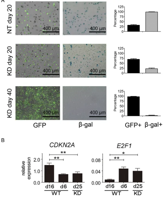 Figure 4. SETD2 inactivation prevents PTECs from senescence by active E2F signaling. (A) GFP and β-gal staining results of NT-day 20, SETD2-day 20 and SETD2-day 40 PTEC cultures