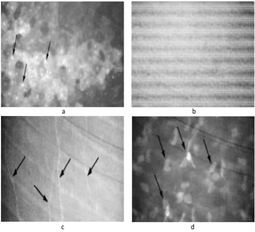 Fig. 4. Corneal abnormal cases: (a) Hyper-reflective nuclei, (b) Basal epithelial cells, (c) Subepithelial nerve, (d) Hyper-reflective keratocyte nuclei