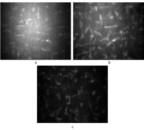 Fig. 7. Confocal stroma images: The darkness and the blurred low contrast features vary from (a) to (c)
