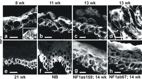 Figure 2Indirect immunofluorescence labeling and CLSM analysis of developing human epidermis for NF1 protein