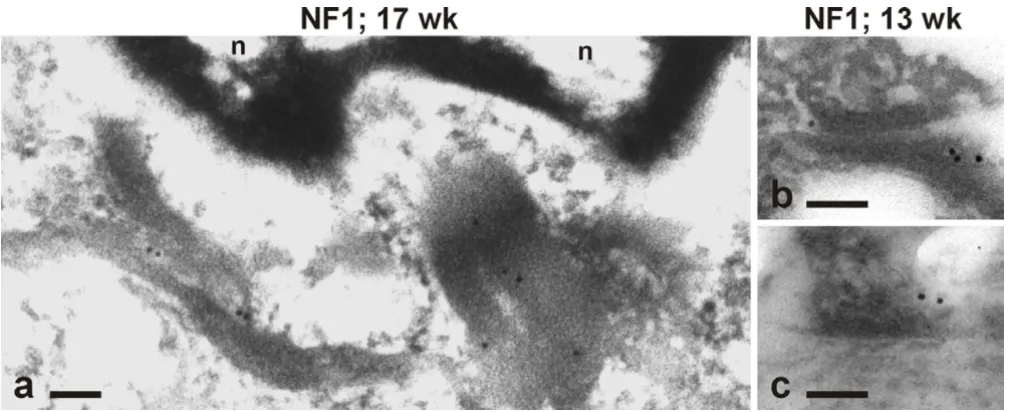 Figure 3Immunoelectron microscopy of the developing human epidermis with NF1GRP(D) antibody