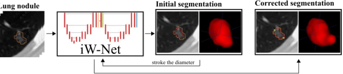 Figure 1.  Automatic and interactive lung nodule segmentations using iW-Net.   ground-truth;   prediction;   