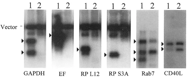 Figure 2. Southern blot analysis of the relative frequencies of 6 different cDNA clones (4 abundant, 1 inter-mediate and 1 rare) in the original and normalized BOTL libraries.
