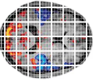 Figure 1: fMRI data with several voxels