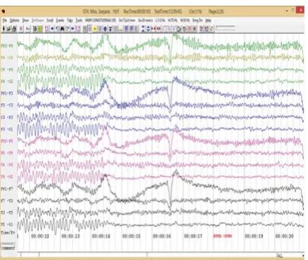 Figure 2: EEG data from the experiment