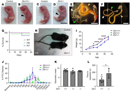 Figure 1. Dlx1/2compared with WT controls (–/– and Dlx2–/– mice have obvious abdominal distention at P0 due to bowel air accumulation, while Dlx1–/– mice exhibit poor weight gain but normal small intestine (SI) transit