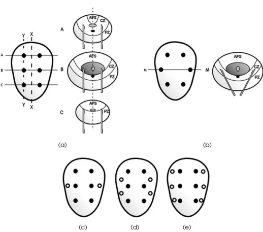 Figure 1.5: Schematic diagram of the various sampling patterns used. (a) The original sextant biopsy scheme as described by Hodge et al