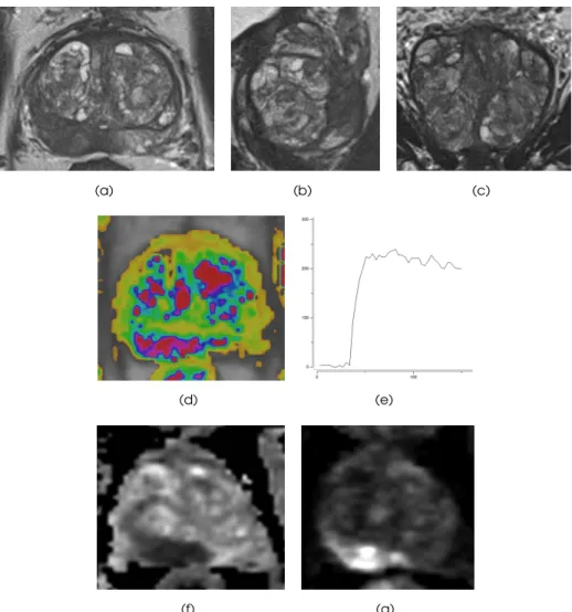 Figure 1.8: Example of a multiparametric MRI. (a) Transversal T2-weighted image. (b) Sagittal T2- T2-weighted image