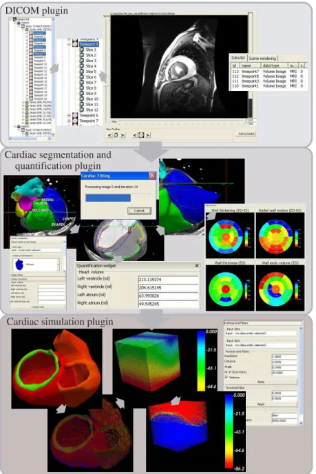 Fig. 2. Cardiac modeling workﬂow as implemented in GIMIAS. From top to bottom are presented the DICOM, the Cardiac segmentation and quantiﬁcation, and the Cardiac simulation plug-ins