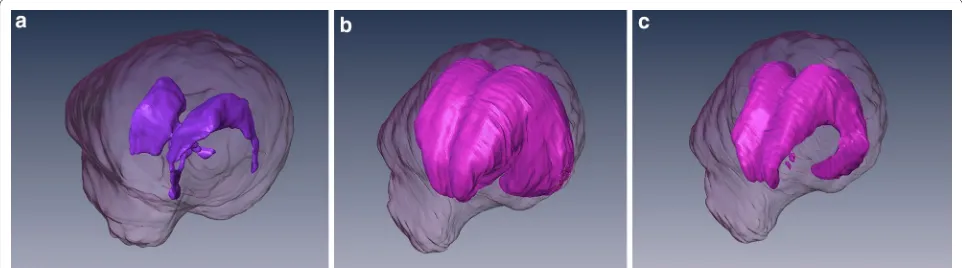 Fig. 1 3D models of the brain and ventricular system of dogs based on manual segmentation of the two dimensional outlines of the ventricular system in MR-images: a Cavalier King Charles spaniel with normal ventricular dimensions