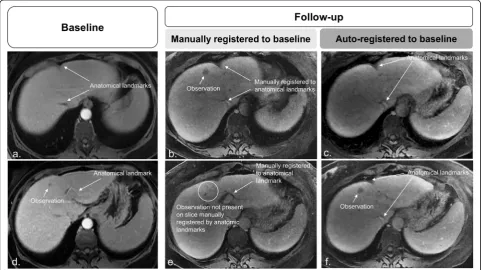 Fig. 5 Manual registration of baseline static (a) and follow-up moving (b, c) images show aligned hepatic veins