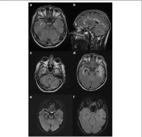 Fig. 1 Axial FLAIR (a) and saggital FLAIR (b) sequences from last surveillance MRI for his MS taken 2 months prior to presentation shows stableperiventricular white matter lesions with evidence of an isolated demyelinating plaque in his right temporal horn