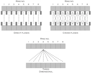 Figure 3:Different data acquisition modes in 2-D acquisition and 3-D PETacquisition [3].