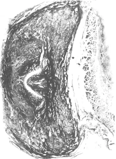 Figure 2 : Section frontale plastifide de la prostate. 