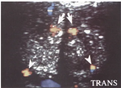 Figure 2 : Anatomie vasculaire en Doppler couleur 