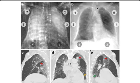 Fig. 5 Dark-field chest radiograph, conventional x-ray, and CT of human body 8. Median visual grading (encircled numbers) of dark-field chestradiograph (a) by three independent readers shows a markedly reduced dark-field signal in left lung lower zone and 