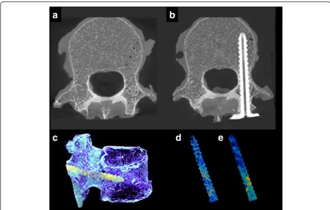 Fig. 3 Micro-CT and MSCT imaging.micro-CT reconstruction of a vertebra with a screw. Cancellous bone area of the pedicle screw extracted by three-dimensional volume position adjustmentbetween the pre- and post-insertion images: micro-CT ( a Micro-CT axial 