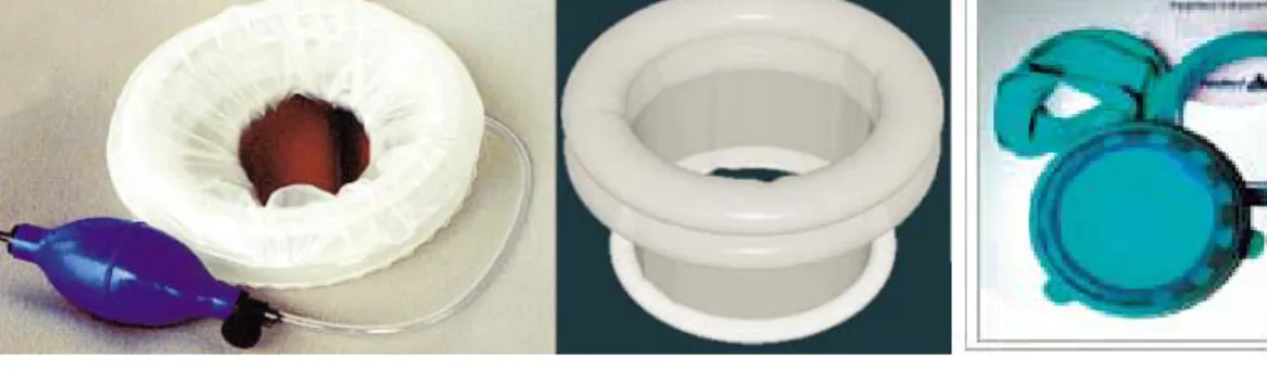 FIGURE 2. “Low tech” solutions to enhancing laparoscopic surgery skills: hand-assist devices.