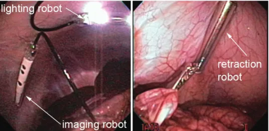 Figure 8. Imaging, lighting, and retraction robots as viewed by endoscope during cooperative NOTES procedure