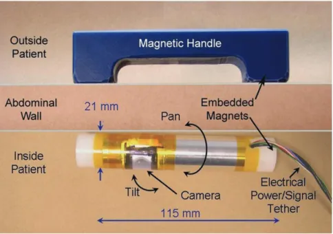 Figure 1. Overview of first-generation peritoneum-mounted imaging robot system. [Color version available online.]