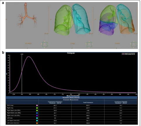 Fig. 1 Example of the semi-automatic software which was used for emphysema quantification